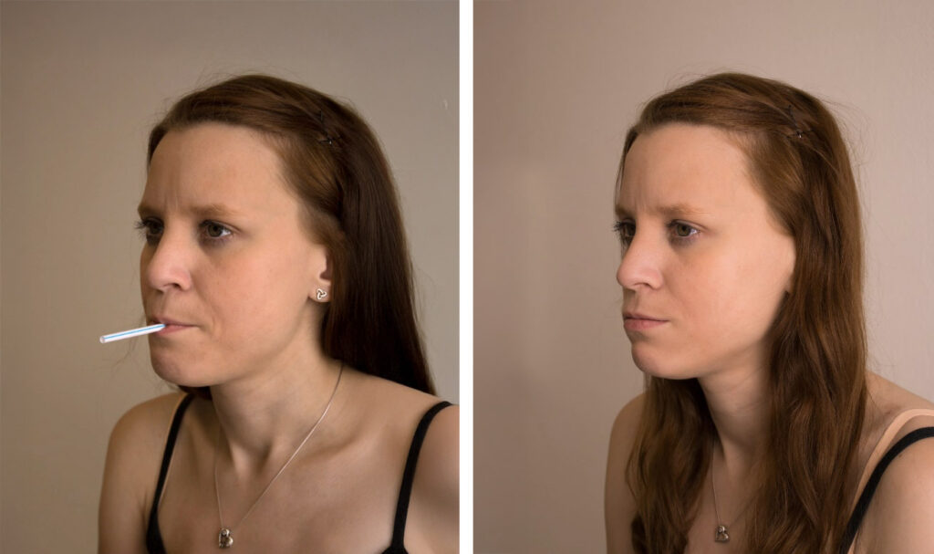 Ausatmung gegen einen leichten Widerstand: Darstellung PEP Atmung