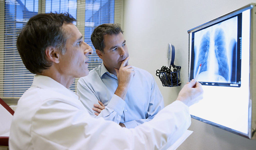 Arzt schaut auf Röntgenbild einer Lunge