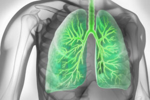 Lunge Asthma bronchiale